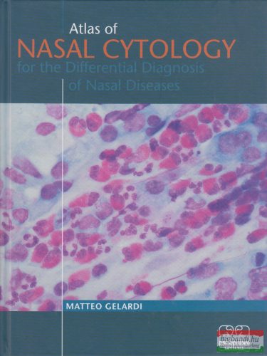Matteo Gelardi - Atlas of Nasal Cytology