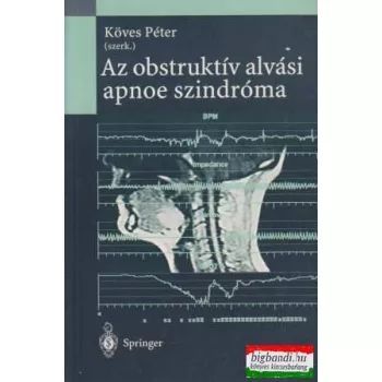Az obstruktív alvási apnoe szindróma