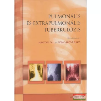   Magyar Pál, Somoskövi Ákos szerk.  -  Pulmonális és extrapulmonális tuberkulózis